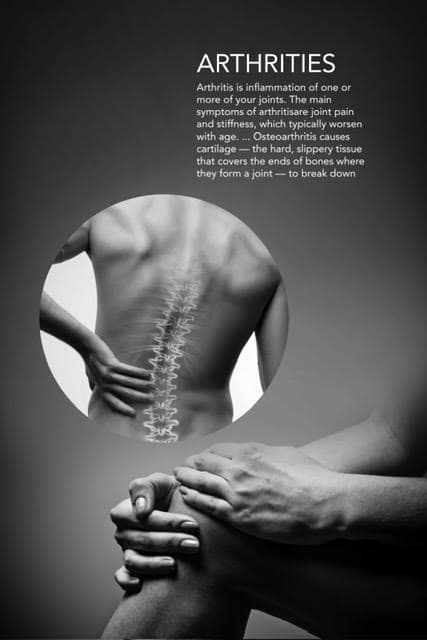 Arthritis treatment - Healthy foods illustration